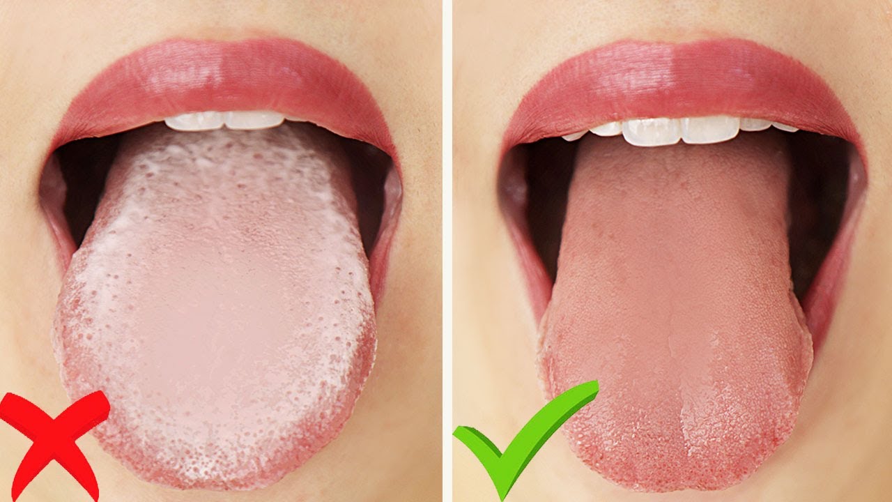 How to Clean your Tongue